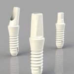 Zirkon, Zirkonyum Seramik – Ceramic İmplant Sağlam mıdır?